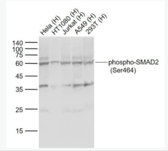 phospho-SMAD2 (Ser464) 磷酸化细胞信号转导分子SMAD2抗体