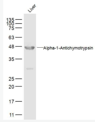 AACT α-1抗胰糜蛋白酶/SERPINA3抗体