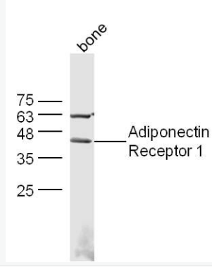 Adiponectin Receptor 1 脂联素受体1抗体