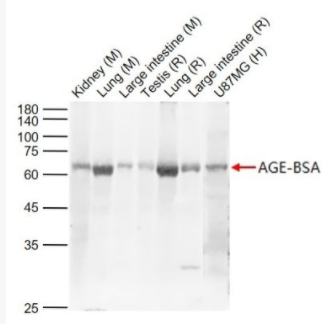  AGEs 晚期糖基化终末产物抗体