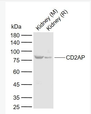 CD2AP 白细胞分化抗原CD2AP抗体