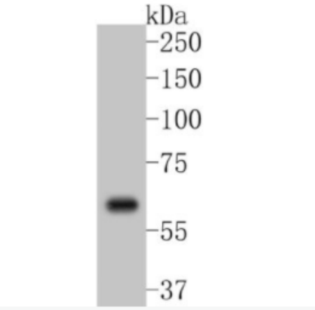 Cyclooxygenase 2 环氧合酶2重组兔单克隆抗体