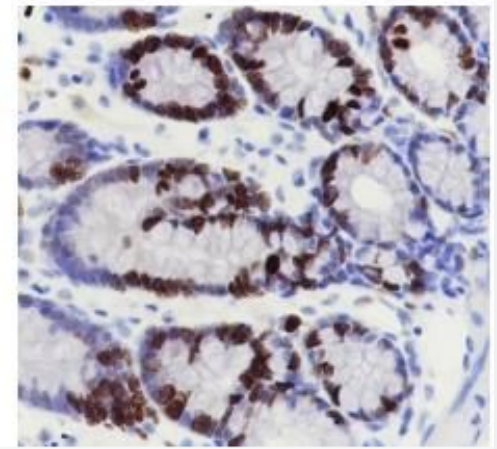 Ki67 Ki67蛋白重组兔单克隆抗体