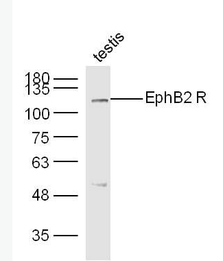 EphB2 酪氨酸蛋白激酶受体B2抗体