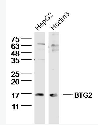 BTG2 B细胞迁移基因2抗体