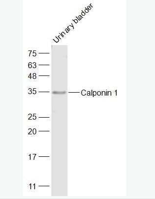  Calponin 1 钙调节蛋白-1抗体