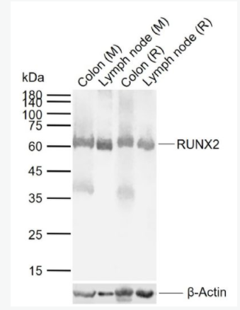 RUNX2 核心结合因子α1/成骨特异性转录因子/Cbfα1抗体
