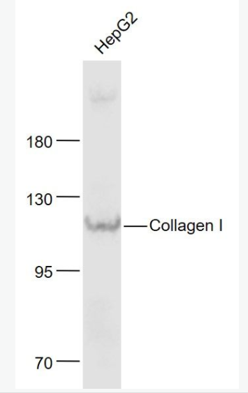 Collagen I I型胶原蛋白抗体