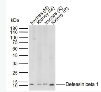 Defensin beta 1 防御素β1/Defensin β1抗体