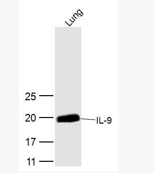 IL-9 白介素9抗体