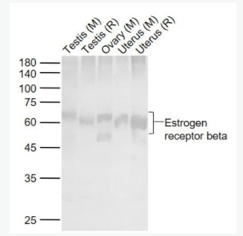 Estrogen receptor beta 雌激素受体β 抗体