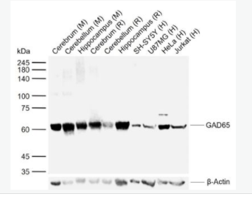 GAD65 谷氨酸脱羧酶-65抗体(C端）