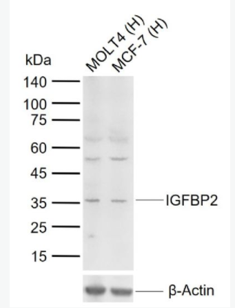 IGFBP2 胰岛素样生长因子结合蛋白2抗体