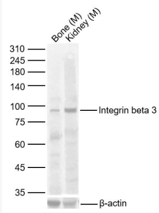ITGB3 整合素β3/CD61抗体