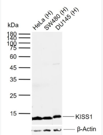 KISS1 肿瘤转移抑制基因抗体