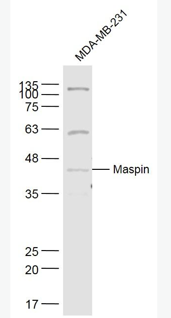 Maspin 抑癌基因抗体