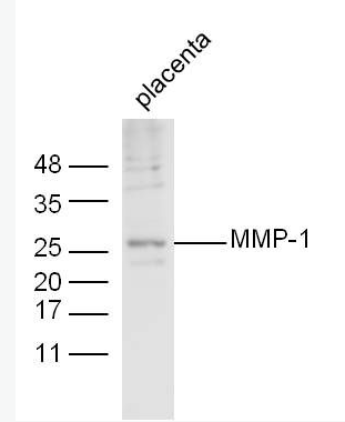 MMP1 基质金属蛋白酶-1抗体