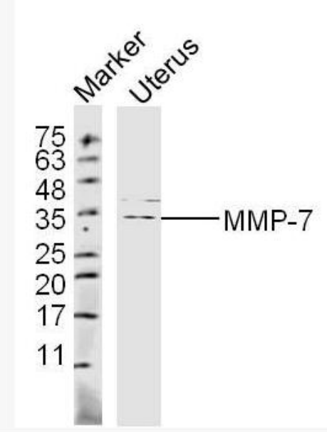MMP7基质金属蛋白酶-7抗体