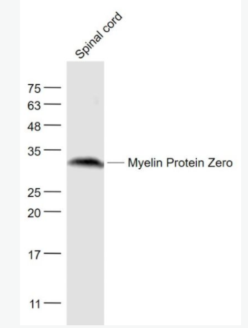 Myelin Protein Zero 外周髓磷脂P0蛋白/P0蛋白抗体