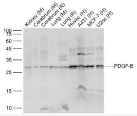 PDGF-B 血小板源性生长因子-B抗体