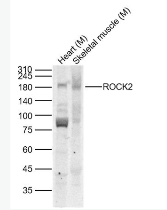 ROCK2 Rho相关蛋白激酶2抗体