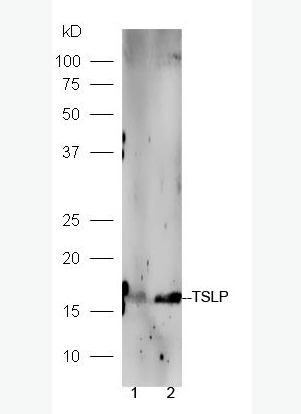 TSLP 胸腺基质淋巴细胞生成素-1抗体