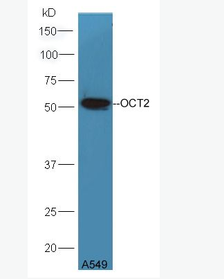 OCT2 阳离子转运蛋白2抗体