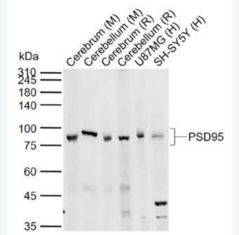 PSD95 突触后密度蛋白95抗体