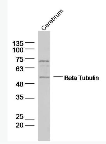 Beta Tubulin 微管蛋白抗体