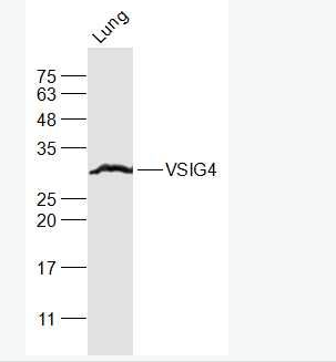 VSIG4 T淋巴细胞负调节蛋白抗体