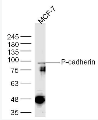 P-cadherin P-钙粘附分子抗体