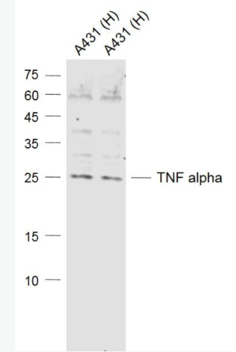 TNF alpha 肿瘤坏死因子-α抗体