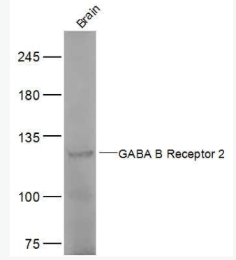 GABBR2  G氨基丁酸B型受体2抗体