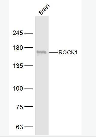 ROCK1 Rho相关蛋白激酶1抗体