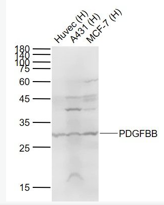 PDGFBB 血小板源性生长因子BB抗体