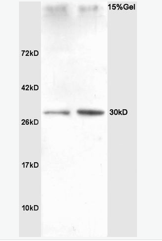 SNAI2 锌指转录因子Slug抗体