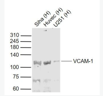 VCAM1 血管内皮细胞粘附分子（CD106）抗体