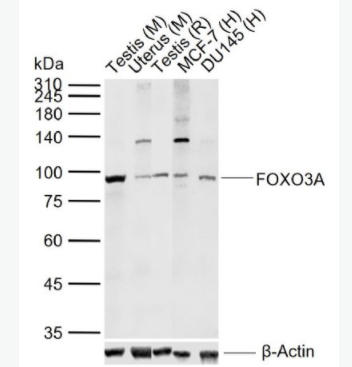 FOXO3A 叉头蛋白O3A抗体