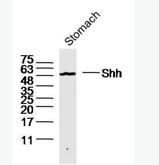 Shh Shh信号转导通路膜蛋白受体抗体