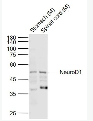 NEUROD1 神经细胞分化因子1抗体