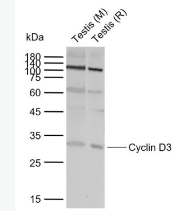 Cyclin D3 周期素D3抗体