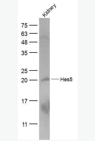HES5 发状分裂相关增强子-5抗体