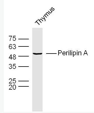 Perilipin A 脂滴包被蛋白Perilipin-A抗体