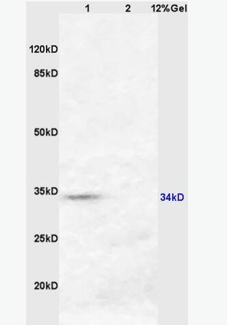 HSD17B3 羟类固醇脱氢酶17β3抗体