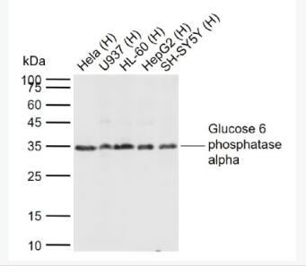 G6PC 葡萄糖6磷酸酶α/G6Pase-α抗体