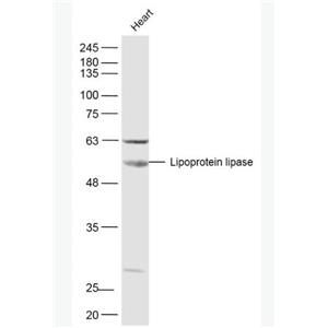 Lipoprotein lipase 脂蛋白脂酶抗体