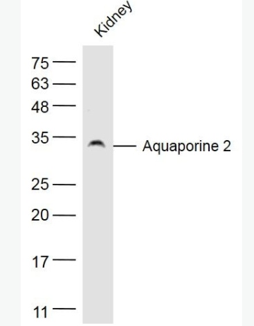 AQP2 水通道蛋白-2抗体