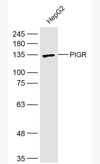 PIGR 多聚免疫球蛋白受体抗体