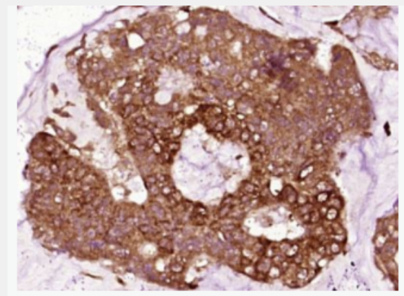 Vinculin  粘着斑蛋白抗体