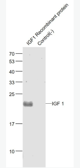 IGF I 胰岛素样生长因子1抗体